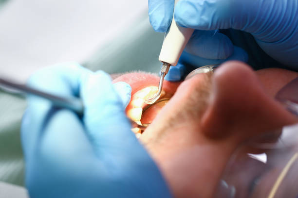 Tooth Infection Emergency Dentist in IN